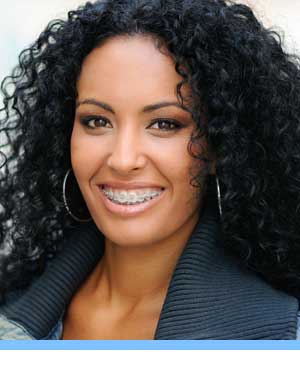 Adult Treatment woman with braces San Marcos Orthodontics San Marcos CA