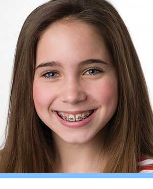 Patient Forms interior photo girl braces San Marcos Orthodontics San Marcos CA